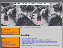 Tablet Screenshot of achiles.blog.cz